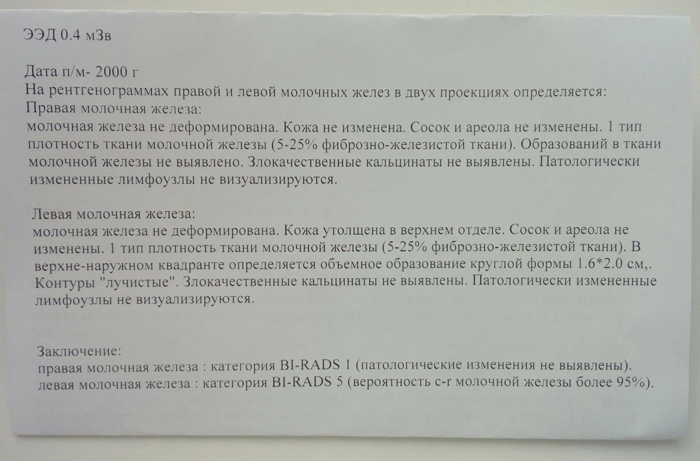 Анализ маммографии. Маммография заключение норма. Рентген протокол описание маммографии. Протокол маммографии в норме. Протокол описания маммографии.