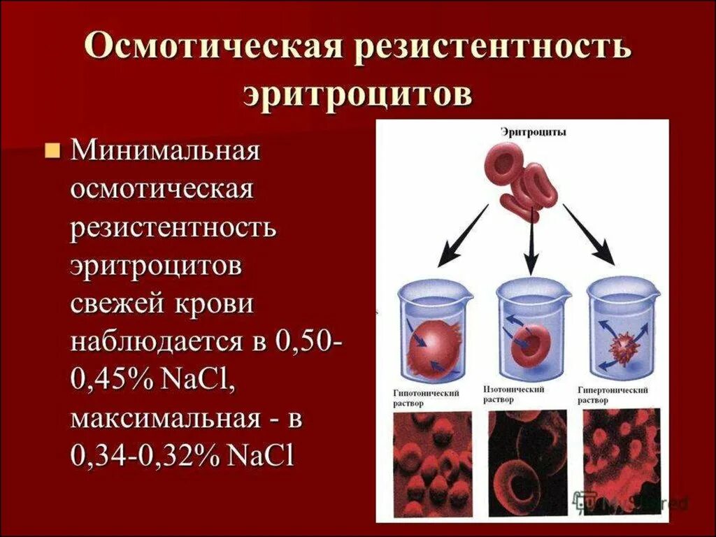 Резистентность крови. Понятие об осмотической резистентности эритроцитов. Методика исследования осмотической стойкости эритроцитов. Снижение осмотической устойчивости эритроцитов. Исследование осмотической резистентности эритроцитов.