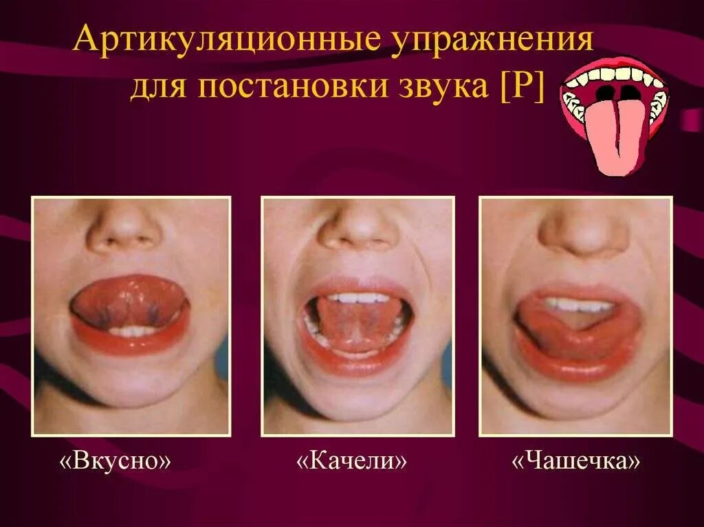 Постановка звука р артикуляционная гимнастика для звука р. Артикуляционная гимнастика для постановки звука р. Упражнения для постановки звука р. Гимнастика для языка звук р. Расстройство речевой артикуляции