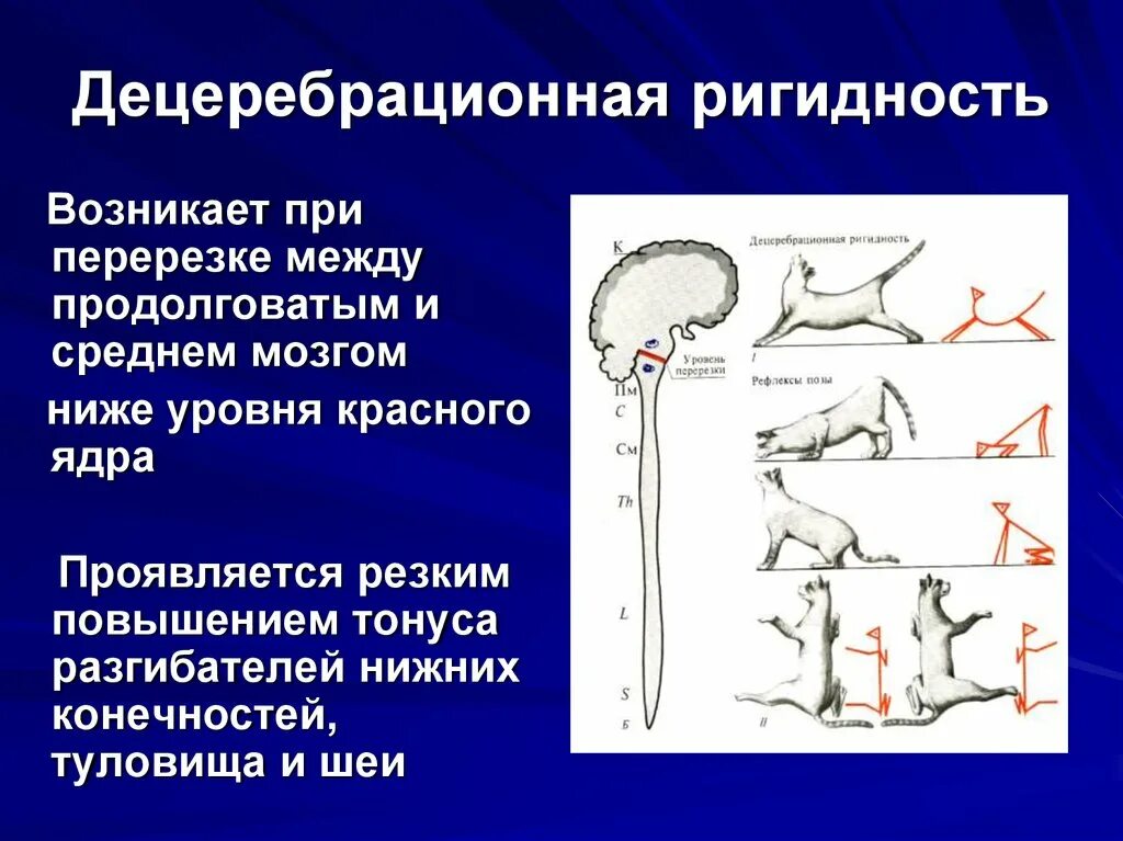 Механизм возникновения децеребрационной ригидности. Децеребрационная ригидность Ориентировочный рефлекс. Децереьоалтная ригилность. Децеребрационная ригидность возникает при перерезке.