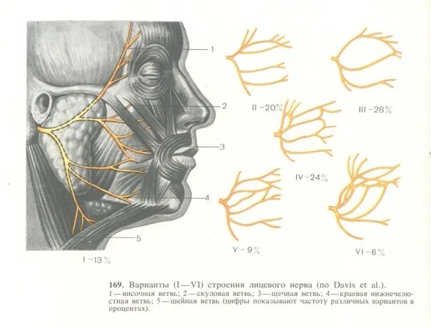 Лицевой нерв анатомия топография. Ветви лицевого нерва схема. Лицевой нерв анатомия ветви. Лицевой нерв анатомия схема. Лицевой нерв тесты