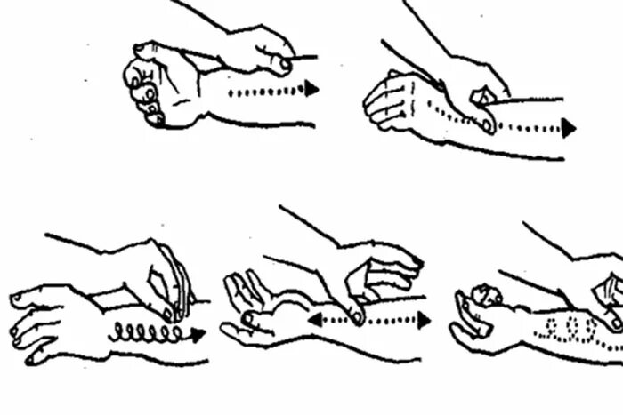 Схема массажа верхних конечностей при переломах. Массаж предплечья схема. Техника массажа лучезапястного сустава после перелома. Массаж при переломах верхних конечностей.