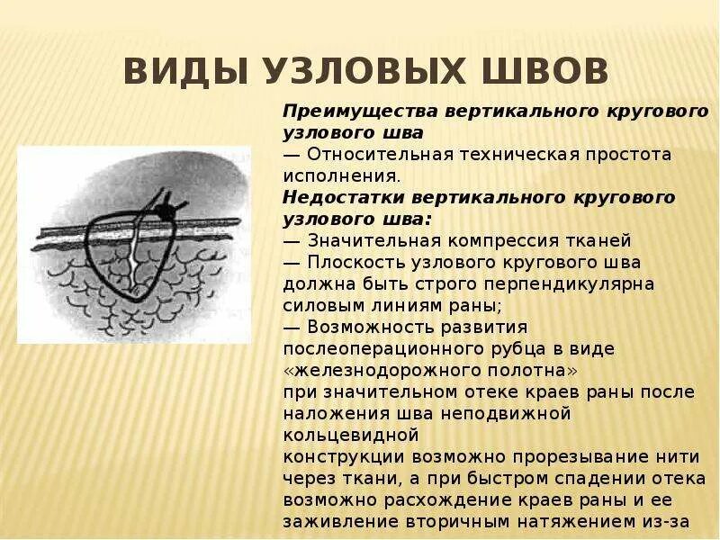 Техника наложения хирургических швов