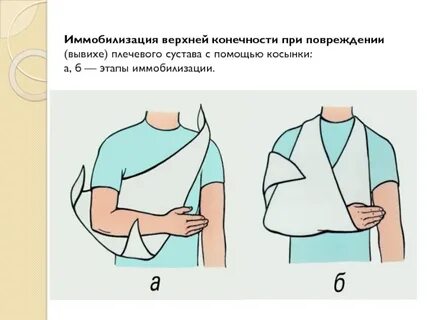 Первая помощь плечо