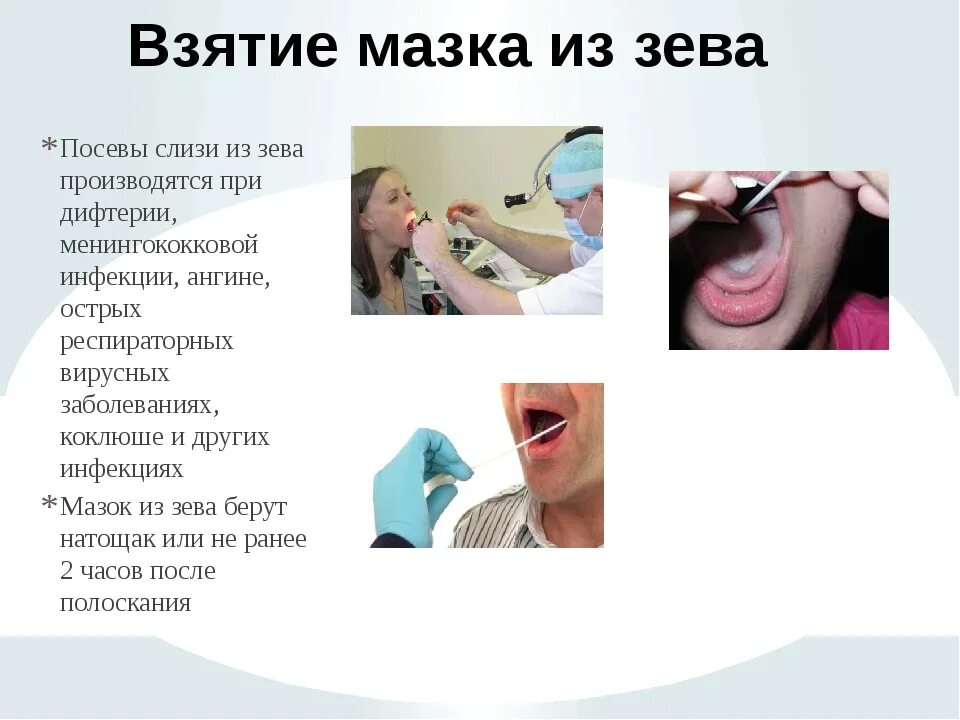 Анализы ротовой полости. Исследование мазка из зева — на дифтерию. Забор мазка из зева на дифтерию.