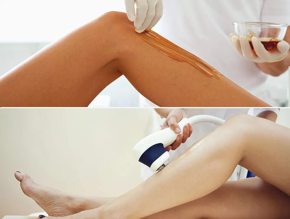 Воск для депиляции. Фотоэпиляция элос. Аппаратная эпиляция. Лазерная депиляция. Лазерная депиляция.
