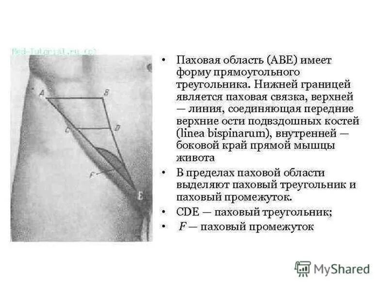 Паховая связка топографическая анатомия. Паховый промежуток топографическая анатомия. Подвздошно паховая область границы. Паховая складка анатомия. Боль в паху операции