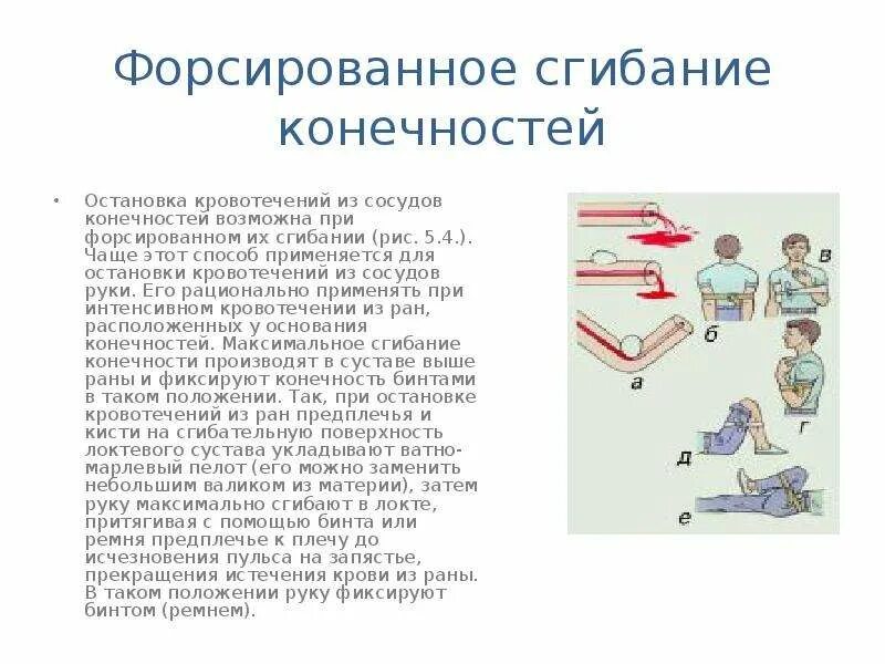 Форсированное сгибание. Способы остановки кровотечения при травмах конечностей. Метод остановки кровотечения путем форсированного сгибания. Приемы остановки кровотечения. Методика остановки кровотечения из артерий.