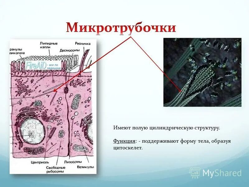 Микротрубочки в какой клетке