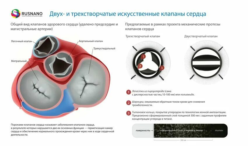 Заменить клапан сердца. Митральный клапан сердца на кт. искусственный митральный клапан на кт. механический митральный клапан сердца. механический трехстворчатый аортальный клапан.