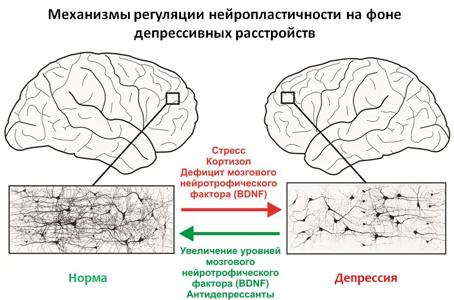 Нейрофизиология депрессии. Нейропластичность мозга. Изменения в мозге при депрессии. Нейропластичность схема.