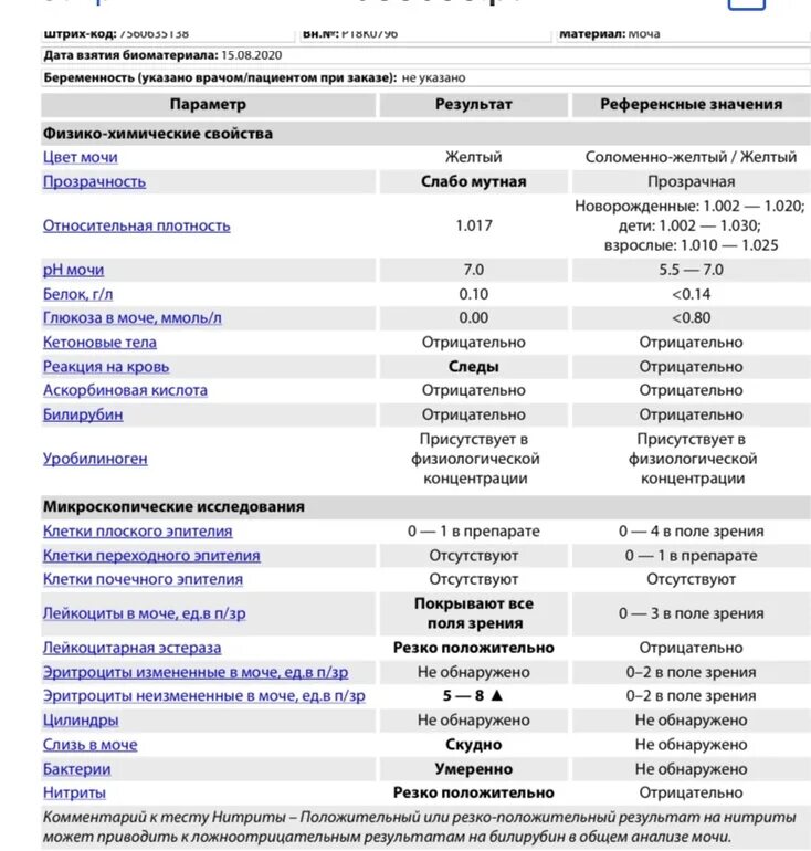 Какой анализ мочи при пиелонефрите. Лейкоциты в моче 1. лейкоциты в моче 17. лейкоциты в моче 2 4 6. анализ мочи лейкоциты норма.
