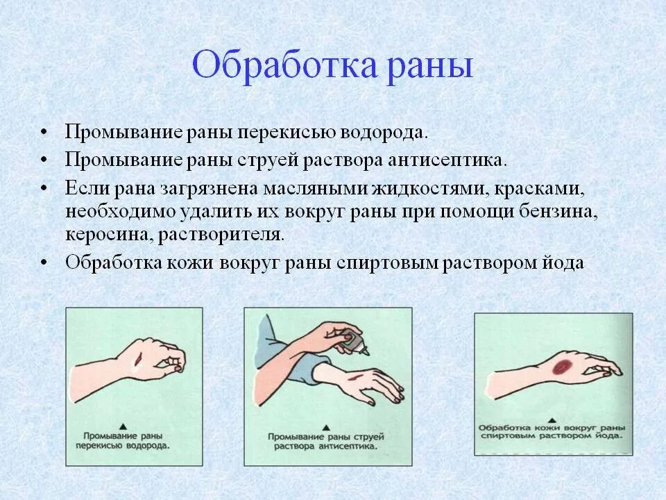 Какой водой промывать рану. Обработка кожи вокруг раны при оказании первой. Что применяют для обработки кожи вокруг раны при оказании 1 помощи. Обработка раны алгоритм. Обработка кожи вокруг раны антисептиком.