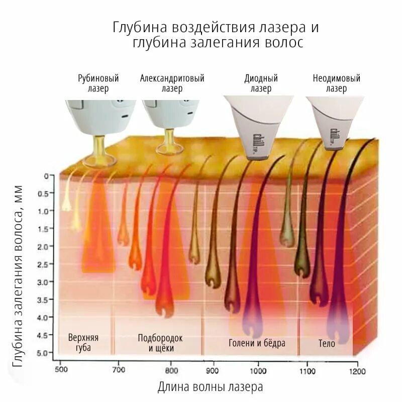 Какой лазер для каких волос