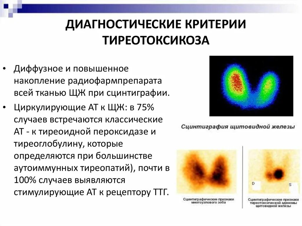 Узловой токсический зоб сцинтиграфия. Сцинтиграфия щитовидной железы ДТЗ. Сцинтиграфия щит железы. Гамма сцинтиграфия щитовидной железы. Диффузный анализ