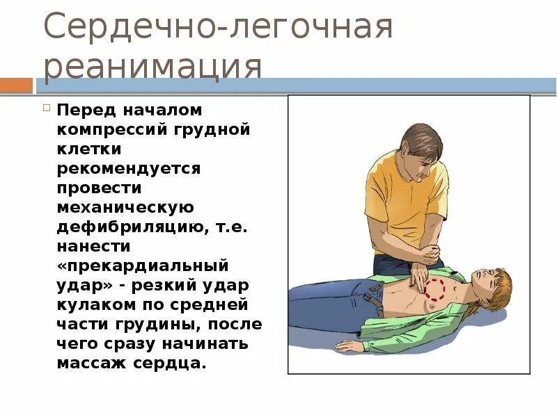 Положение после реанимации. Сердечно-лёгочная реанимация. прекардиальный удар при проведении сердечно легочной реанимации. место проведения сердечно легочной реанимации.