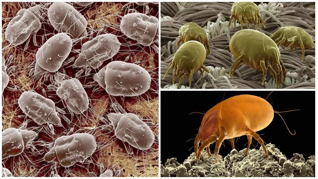 Бактерии клещей. Клещ сапрофит под микроскопом. Сапрофиты пылевые клещи. Клещ Dermatophagoides farinae. Клещ Derm pteronyssinus что это.