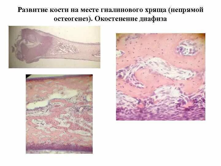 Развитие хряща гистология. Непрямой остеогенез развитие трубчатой кости. развитие кости на месте хряща непрямой остеогенез. развитие кости на месте гиалинового хряща непрямой остеогенез. развитие кости на месте хряща непрямой остеогенез препарат.