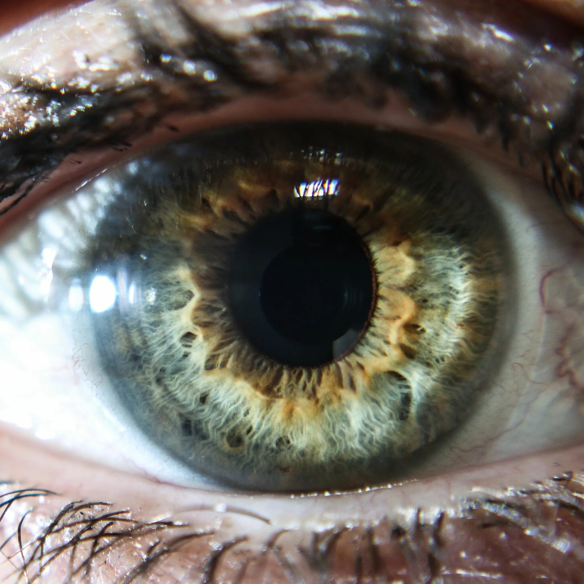 Буро желтые глаза. Центральная гетерохромия Радужки глаз. Центральная гетерохромия карих глаз. Центральная гетерохромия зеленый Карий. Центральная гетерохромия глаз Карий и зеленый.