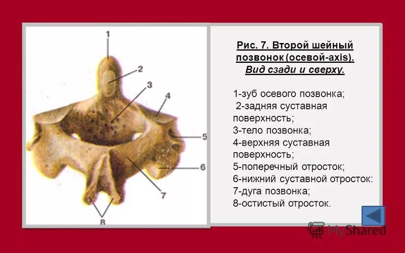 Тело позвонка шейного