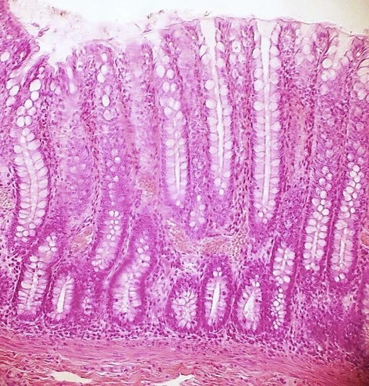 Ткани толстой кишки. Эпителий тонкой кишки гистология. Тонкая кишка гистология препарат. Препарат толстой кишки гистология. Тонкая кишка микропрепарат гистология.