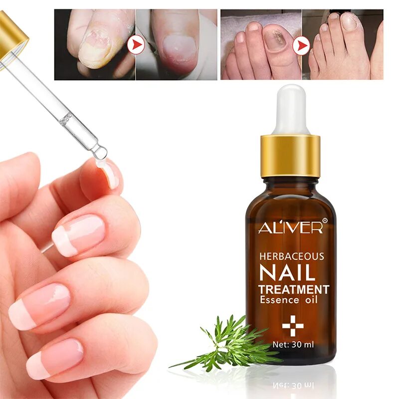 Китайское средство от грибка fungal Nail treatment. Китайская жидкость от грибка ногтей. Эссенция для ногтей.