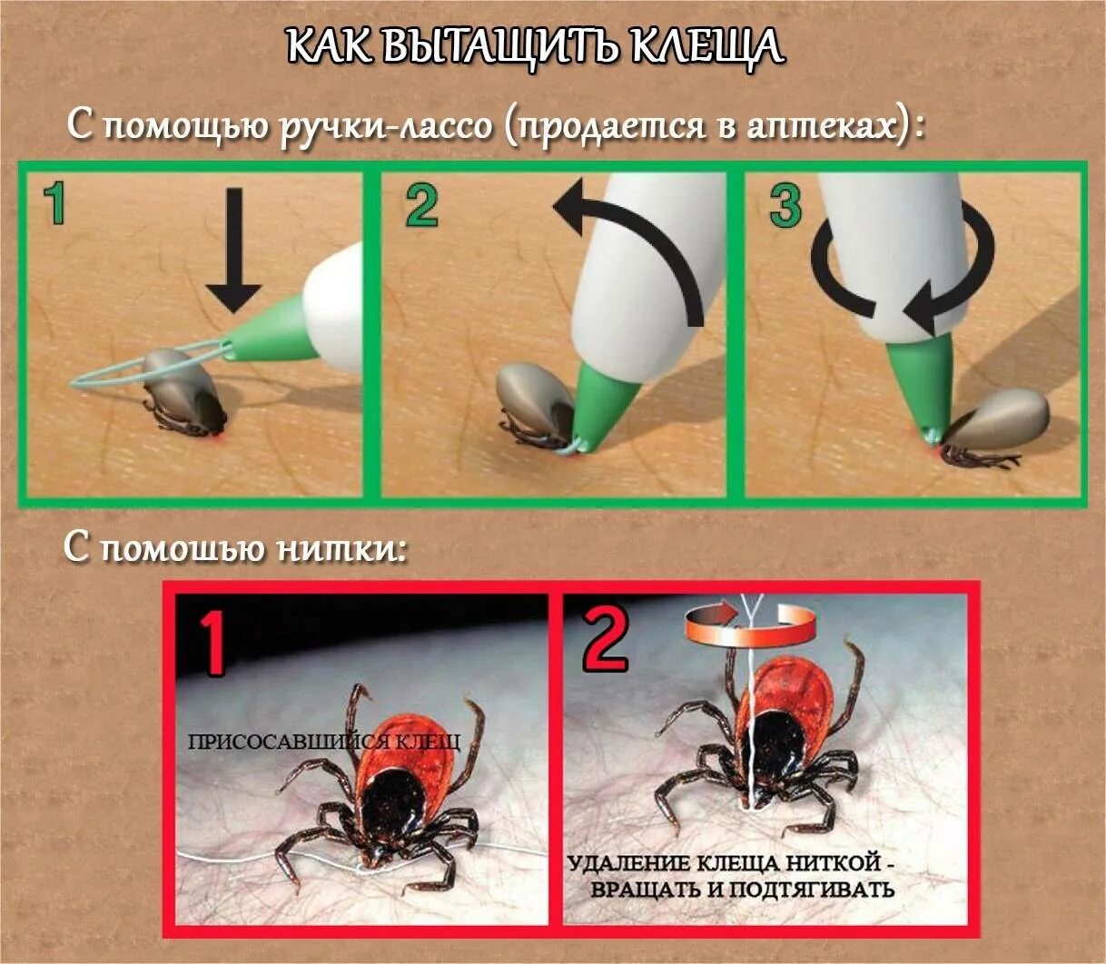Как достать клеща с помощью нитки. Как достать клеща у человека в домашних условиях. Как правильно извлечь клеща. Как вытащить клеща у человека в домашних условиях правильно.