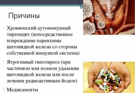 Тиреоидит причины возникновения