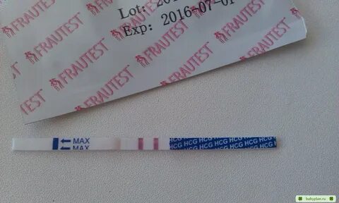 Рокко кесімі