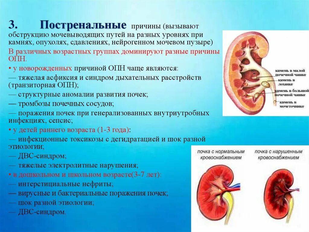 Заболевание почек гидронефроз. Гидронефроз профилактика. Осложнения гидронефроза. Обструкция нижних мочевых путей. Профилактика гидронефроза у детей.