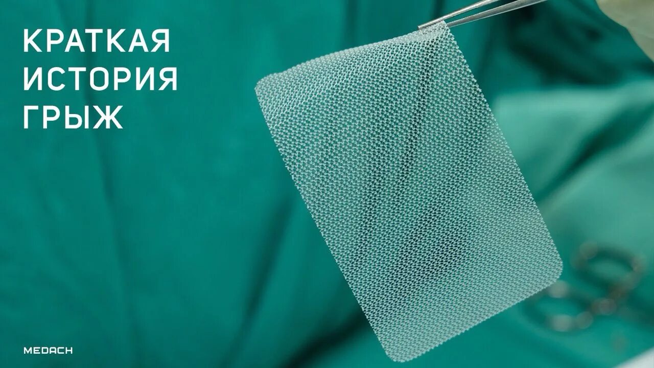 лечение бедренной грыжи. причины бедренной грыжи. лимфаденит и паховая грыжа дифференциальная диагностика. дифференциальная диагностика пупочной грыжи. грыжа l5-s1.