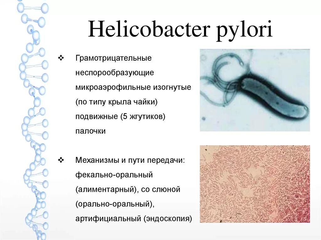 Хеликобактер микроскопия. Хеликобактер пилори морфология. Пути передачи хеликобактер пилори. Хеликобактер пилори микробиология. Как можно заразиться хеликобактер