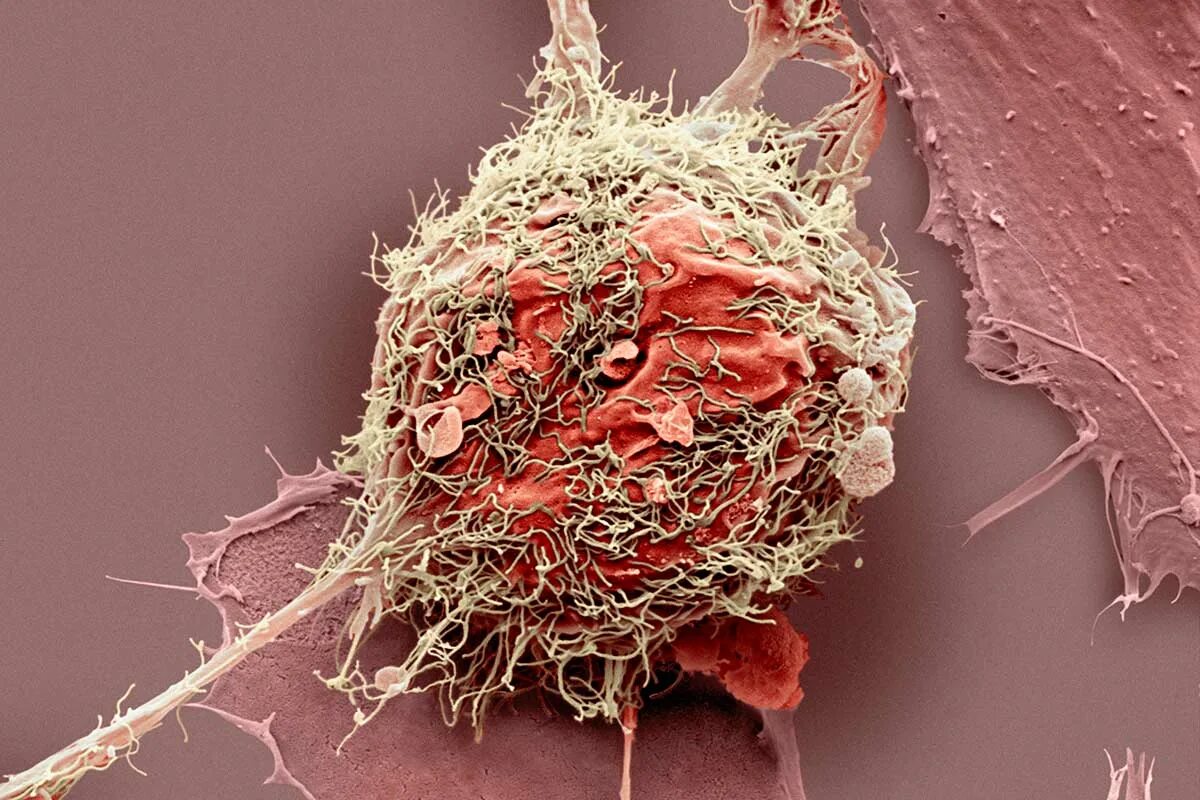 Lack of Correlation in Cancer Cells May Complicate Drug Development - BioResearc