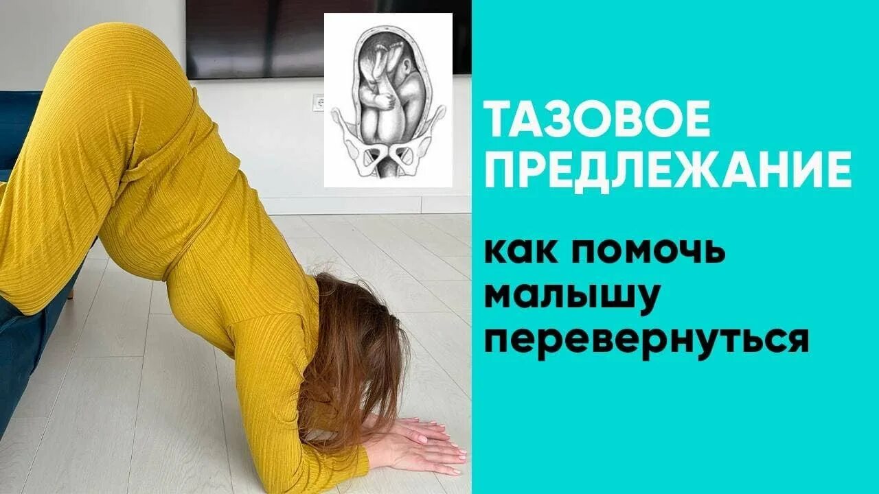 Тазовое предлежание упражнения. Коленно-локтевая поза. Упражнения чтобы малыш перевернулся. Поза для переворота плода.