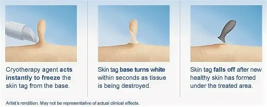 Remove tags. Remove tags