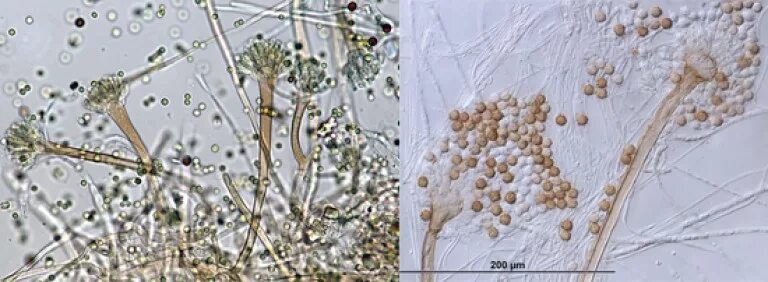 Споры грибов семена. Конидии аспергилла. Плесневые грибы аспергиллус. Микроскопия аспергилл. Плесневый гриб аспергилл.