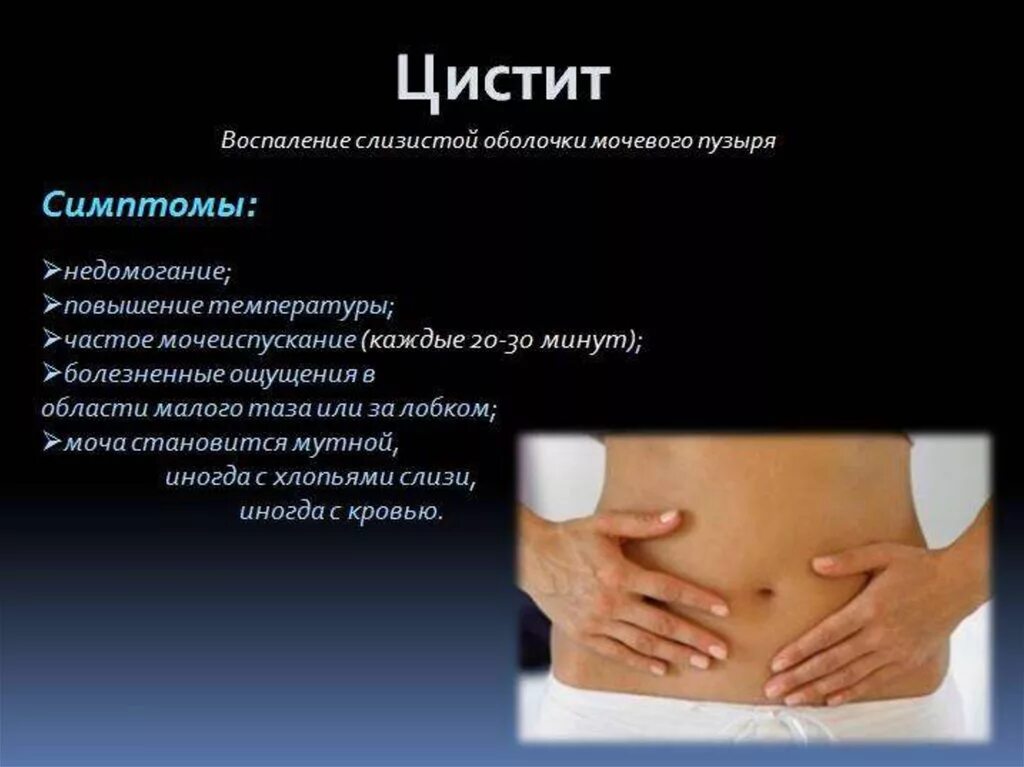 Какие симптомы мочевого пузыря. Цистит симптомы. симптомы цистицистита. признаки цистита. цистит у женщин.