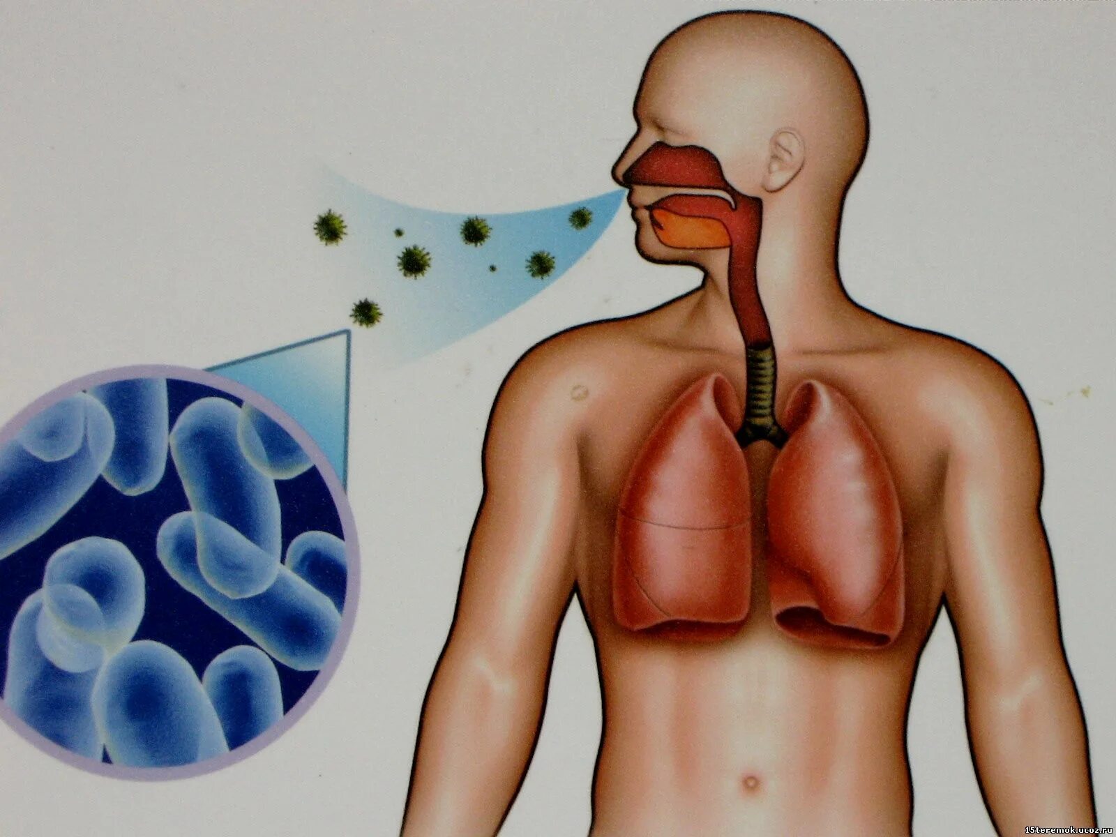 Туберкулез tuberculosis. Палочка Коха туберкулез. Воздушно-капельные инфекции туберкулез.