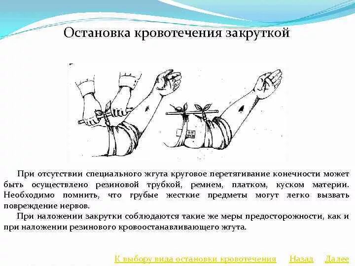 Метод остановки артериального кровотечения закруткой. Остановка артериального кровотечения жгутом закруткой. Временная остановка кровотечения наложение жгута закрутки. Жгут закрутка при артериальном кровотечении алгоритм. Чем можно остановить кровотечение