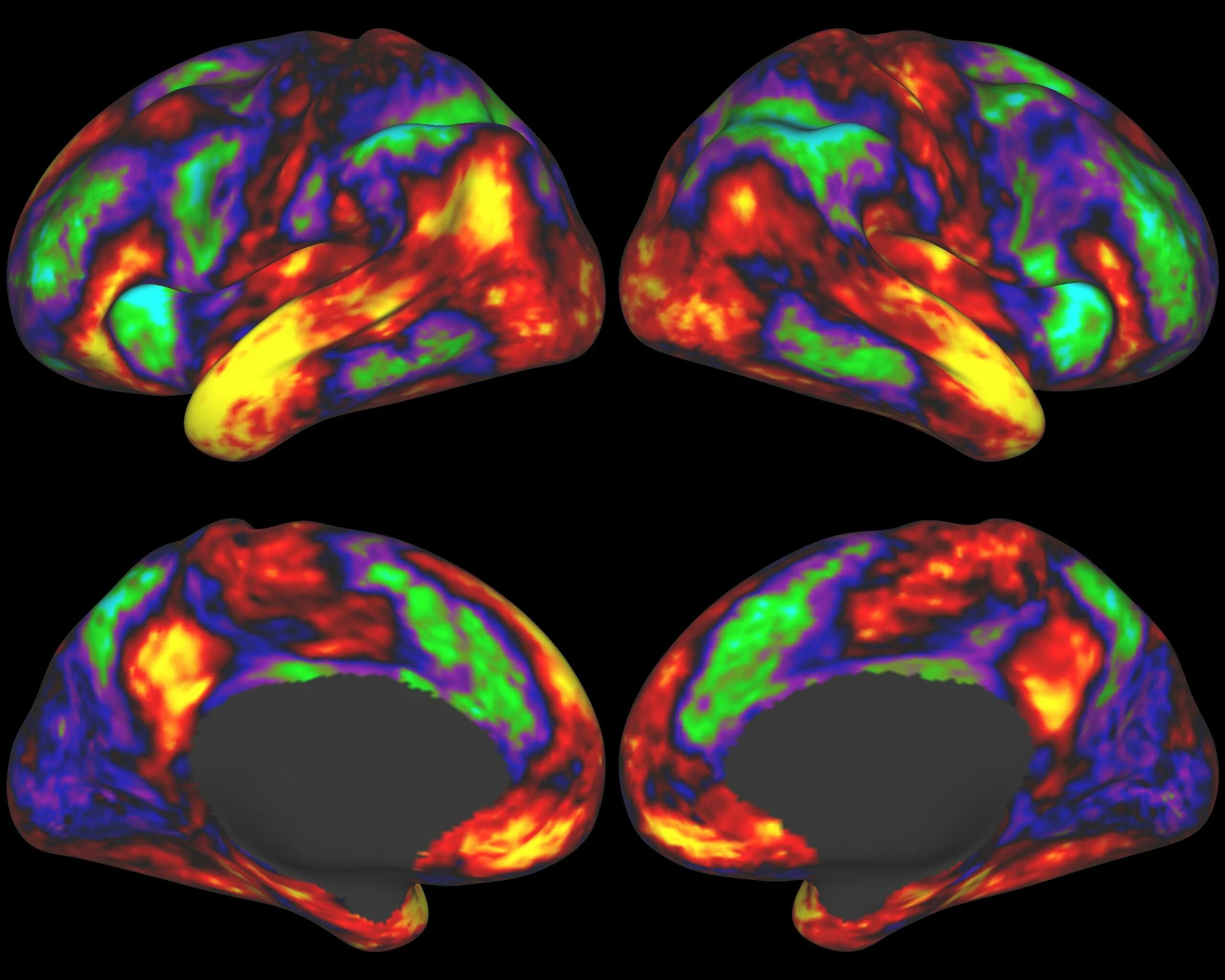 Коннектом мозга. Трактография головного мозга. Проект коннектом. ФМРТ И искусство. Brain карта