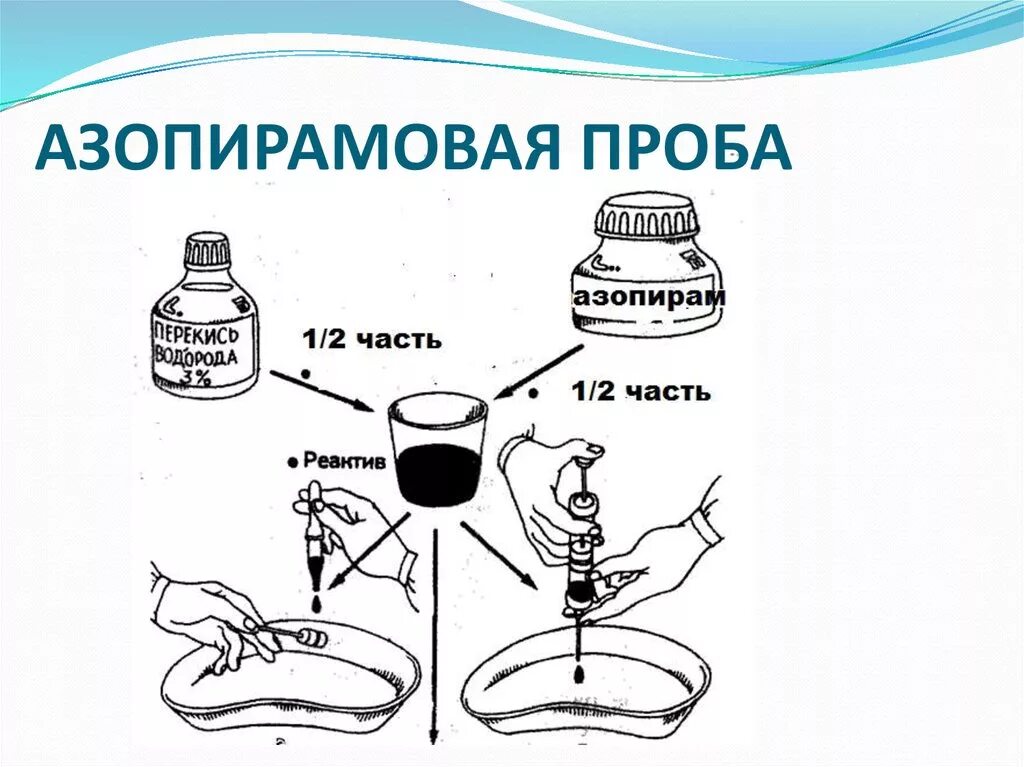 Результаты азопирамовой пробы. Азопирам проба техника проведения. Технология постановки азопирамовой пробы. Рабочий раствор азопирамовой пробы. Алгоритм проведения азопирамовой пробы на качество ПСО.