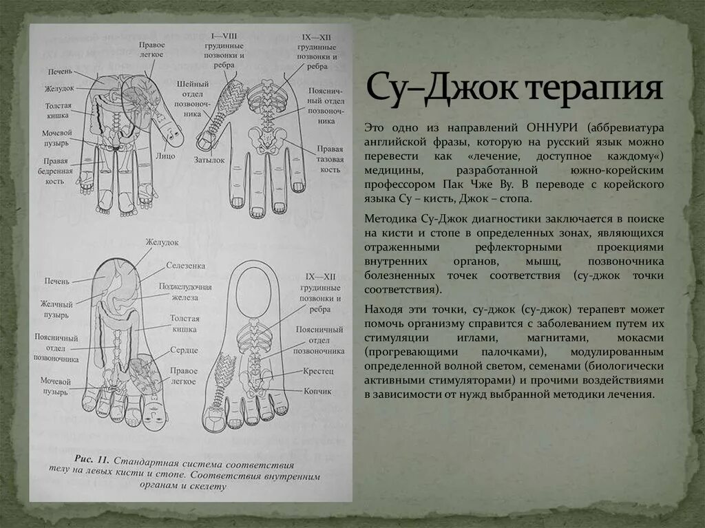 Су джок академия сайт. Су Джок терапия кисть. Су Джок моксы точки. Су-Джок акупунктура техники. Методика Су Джок терапия.