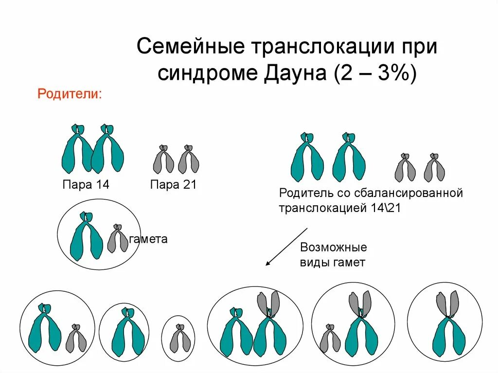 Транслокационные формы синдрома Дауна. Транслокационная форма болезни Дауна. Робертсоновские транслокации и синдром Дауна. Транслокационная форма синдрома Дауна кариотип. Варианты синдрома дауна