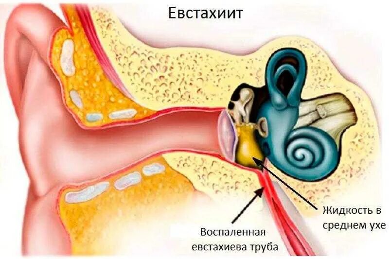 Давление в среднем ухе атмосферное