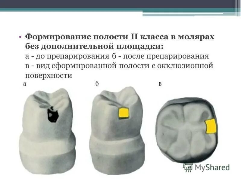 Этап формирования полости