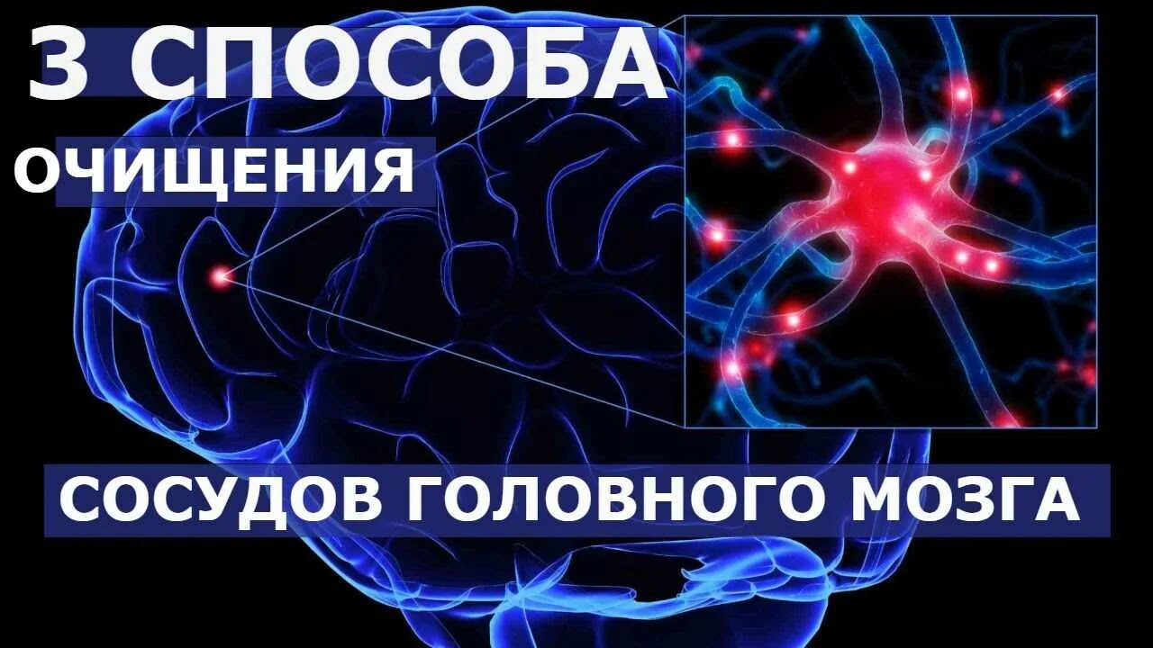 Сосуды головного мозга лечение народными средствами. Чистка сосудов головного. Очищение сосудов головного мозга. Средство для очищения сосудов головного мозга. Препараты для очистки сосудов головного мозга.