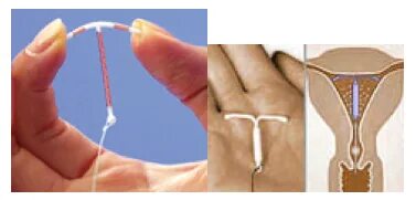 Yalangoch Yu Rutberg