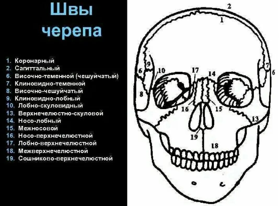 Соединение между лобной и теменной костями. Швы соединяющие кости черепа. Клиновидно-скуловой шов черепа. Кости черепа лобный шов. Клиновидно-лобный шов черепа.