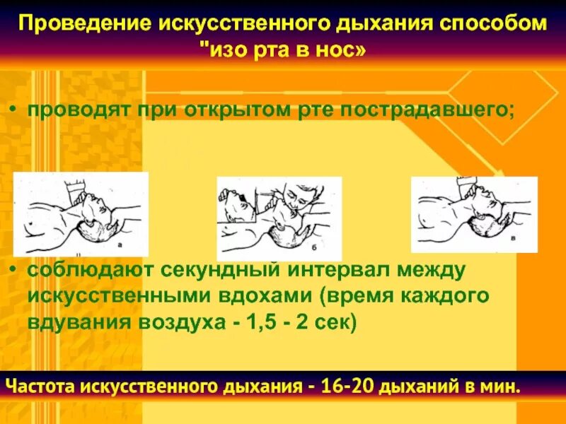 Частота искусственного дыхания в минуту. При проведении искусственного дыхания методом рот в нос. Частота вдохов в минуту при проведении искусственного дыхания. Способы проведения искусственного дыхания. Интервал искусственного дыхания.