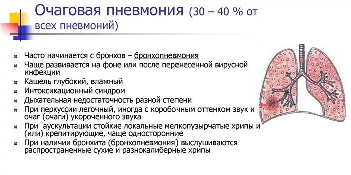 Лечение поражения легких. Пневмококковая пневмония у детей клинические рекомендации. Двухсторонней очаговая пневмония; пневмония. Очаговая бронхопневмония признаки. Острая очаговая бронхопневмония.